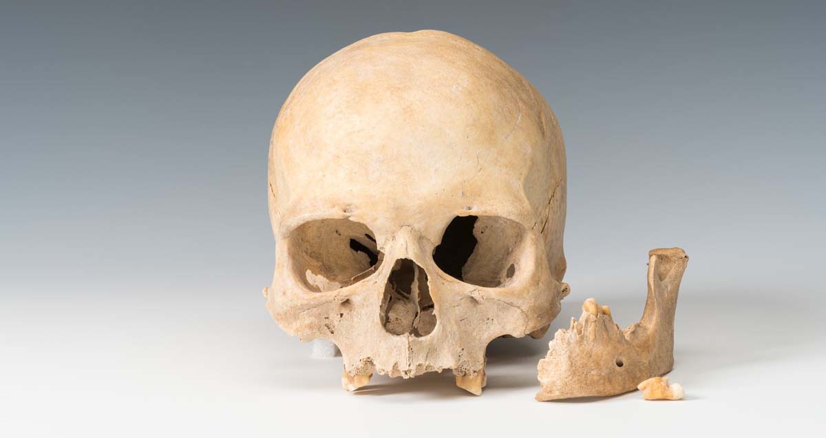 Abb. 1: Carwitz, Lkr. Mecklenburgische Seenplatte. Der bei der Sandgewinnung am oder auf dem Hauptmannsberg entdeckte Frauenschädel.